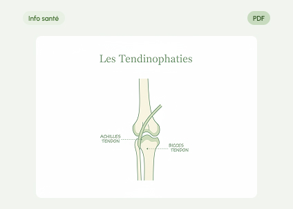 Les Tendinopathies